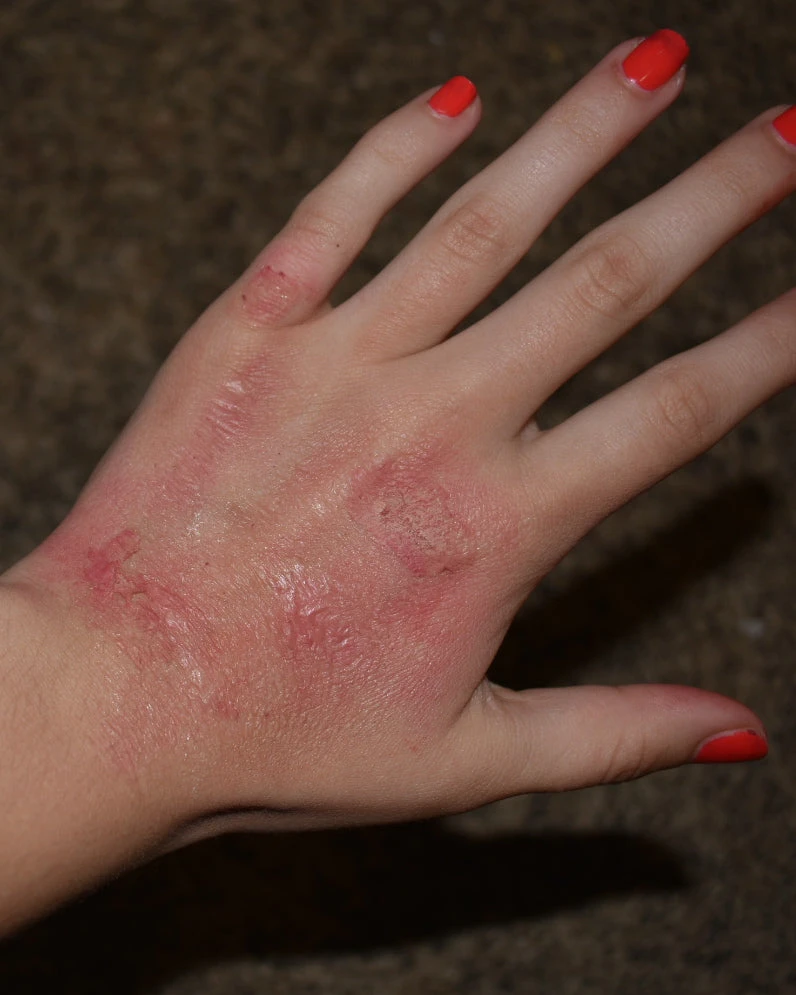 Morris Rigid Collodion Costume Accessories 4 Morris Rigid Collodion Costume Accessories