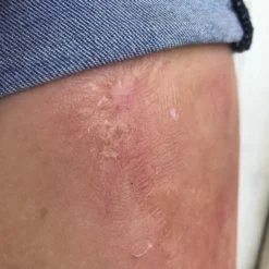 Morris Rigid Collodion Costume Accessories 7 Morris Rigid Collodion Costume Accessories