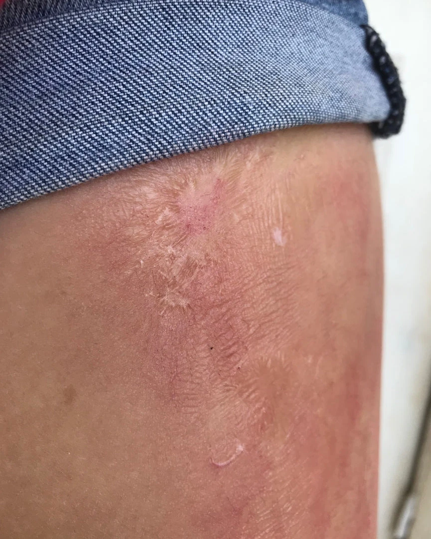 Morris Rigid Collodion Costume Accessories 5 Morris Rigid Collodion Costume Accessories